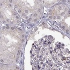 Anti-MPP5 Antibody