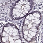 Immunohistochemical staining of human colon using Anti-MPP5 antibody HPA000993.