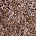 Anti-TXN2 Antibody