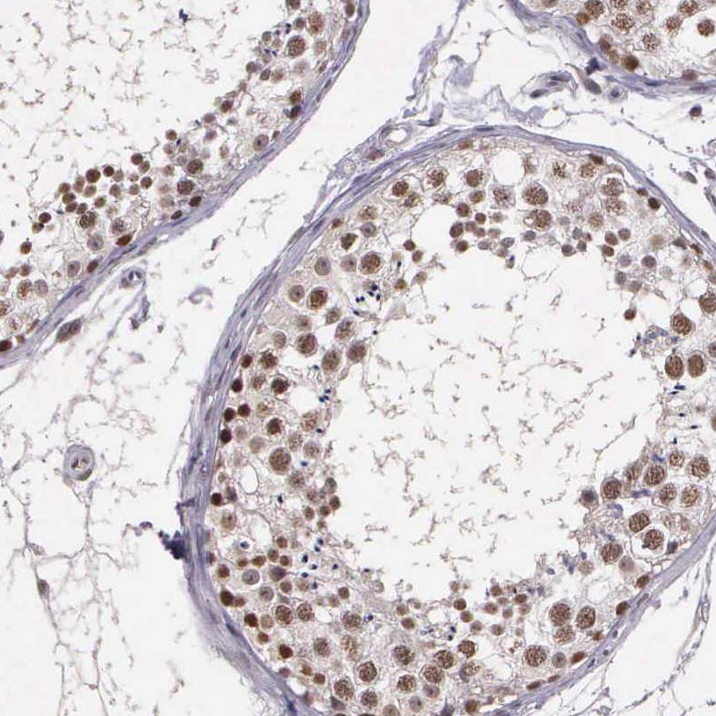 Anti-ARMCX5 Antibody