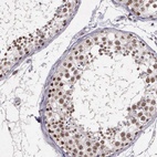 Anti-ARMCX5 Antibody