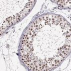 Anti-ARMCX5 Antibody