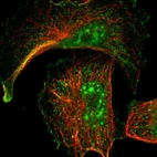 Immunofluorescent staining of human cell line U-251 MG shows localization to nuclear speckles, plasma membrane & cytosol.