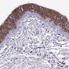 Anti-IGBP1 Antibody