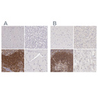 Immunohistochemical staining of human cerebral cortex, liver, lymphoid tissues and skeletal muscle using Anti-ARHGAP4 antibody HPA001012 (A) shows similar protein distribution across tissues to independent antibody HPA001083 (B).