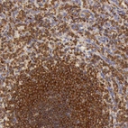Immunohistochemical staining of human spleen shows strong cytoplasmic positivity in cells in red pulp and white pulp.