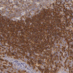 Anti-ARHGAP4 Antibody