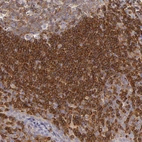 Immunohistochemical staining of human tonsil shows strong cytoplasmic positivity in germinal and non germinal center cells.