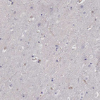 Anti-ARHGAP4 Antibody