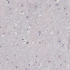 Immunohistochemical staining of human cerebral cortex shows very weak cytoplasmic positivity in neuronal cells.