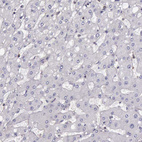 Immunohistochemical staining of human liver shows very weak cytoplasmic positivity in hepatocytes.