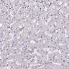 Anti-ARHGAP4 Antibody