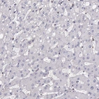 Immunohistochemical staining of human liver shows very weak cytoplasmic positivity in hepatocytes.