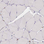 Immunohistochemical staining of human skeletal muscle shows very weak cytoplasmic positivity in myocytes.