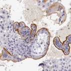 Anti-TCEANC Antibody