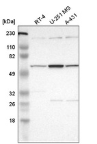 Western blot analysis in human cell line RT-4, human cell line U-251 MG and human cell line A-431.