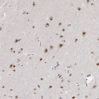 Anti-PHF6 Antibody