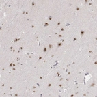 Immunohistochemical staining of human cerebral cortex shows moderate nuclear and nucleolar positivity in neurons.