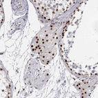 Immunohistochemical staining of human testis shows strong nuclear positivity in Leydig cells.
