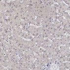 Immunohistochemical staining of human liver shows no positivity in hepatocytes as expected.