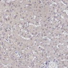 Immunohistochemical staining of human liver shows no positivity in hepatocytes as expected.
