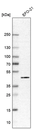 Western blot analysis in human cell line EFO-21.