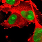 Immunofluorescent staining of human cell line U-251 MG shows localization to nucleus & nucleoli.