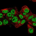 Anti-PROX1 Antibody