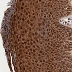 Immunohistochemical staining of human skin shows strong cytoplasmic and membranous positivity in squamous epithelial cells.