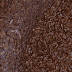 Immunohistochemical staining of human tonsil shows strong cytoplasmic and membranous positivity in germinal and non germinal center cells.