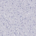 Immunohistochemical staining of human cerebral cortex shows very weak positivity in neuronal cells.