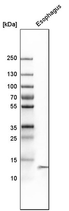 Western blot analysis in human esophagus tissue.