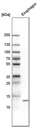 Western blot analysis in human esophagus tissue.