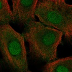 Immunofluorescent staining of human cell line hTCEpi shows localization to nucleus & cytosol.