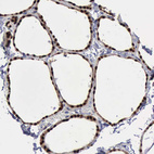 Anti-PDCD4 Antibody