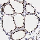 Immunohistochemical staining of human thyroid gland shows strong nuclear positivity in glandular cells.