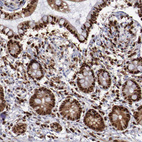 Anti-PDCD4 Antibody