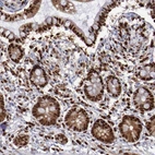 Immunohistochemical staining of human small intestine shows strong nuclear positivity in glandular cells.