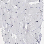 Immunohistochemical staining of human skeletal muscle shows no positivity in myocytes as expected.