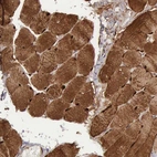 Immunohistochemical staining of human skeletal muscle shows strong cytoplasmic positivity in myocytes.