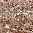 Anti-FHL1 Antibody