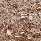 Immunohistochemical staining of human heart muscle shows strong cytoplasmic positivity in cardiomyocytes.