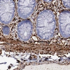 Immunohistochemical staining of human colon shows strong cytoplasmic positivity in smooth muscle cells.