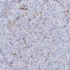 Immunohistochemical staining of human pancreas shows no cytoplasmic positivity in exocrine glandular cells.