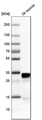 Western blot analysis in human skeletal muscle tissue.