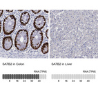 Anti-SATB2 Antibody