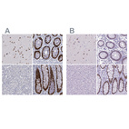 Immunohistochemical staining of human cerebral cortex, colon, liver and rectum using Anti-SATB2 antibody HPA001042 (A) shows similar protein distribution across tissues to independent antibody HPA029543 (B).