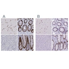 Immunohistochemical staining of human cerebral cortex, colon, liver and rectum using Anti-SATB2 antibody HPA001042 (A) shows similar protein distribution across tissues to independent antibody HPA029543 (B).