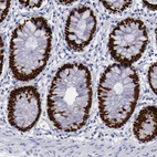 Immunohistochemical staining of human colon shows strong nuclear positivity in glandular cells.