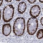Immunohistochemical staining of human colon shows strong nuclear positivity in glandular cells.